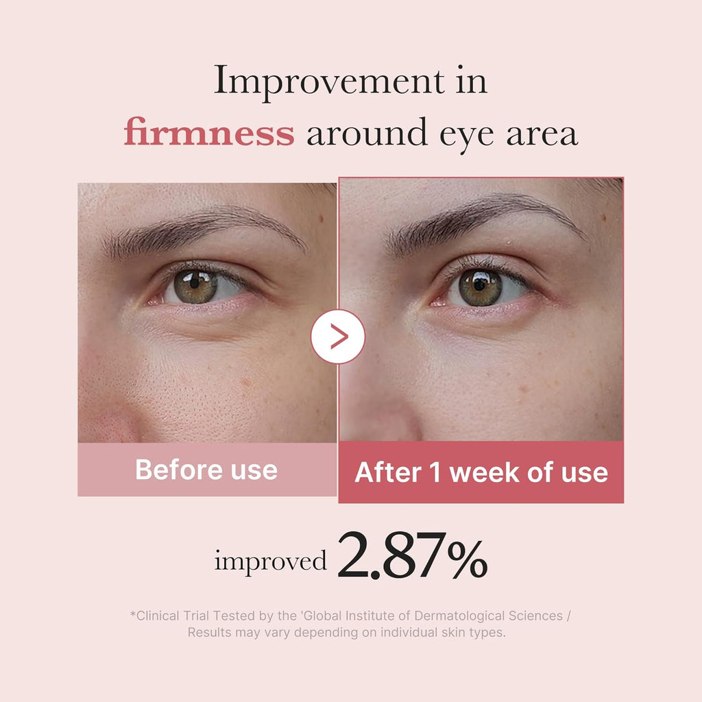 Eye Serum with Salmon DNA PDRN & Pink Peptides | 99% Purity Retinol for Fine Lines | PDRN & Niacinamide for Uneven Skin Tone | Korean Skincare, 1.01 Fl.Oz